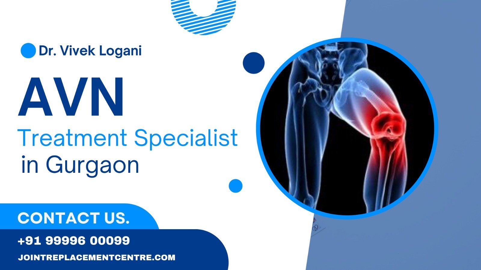 Unicondylar Knee Replacement in Gurgaon